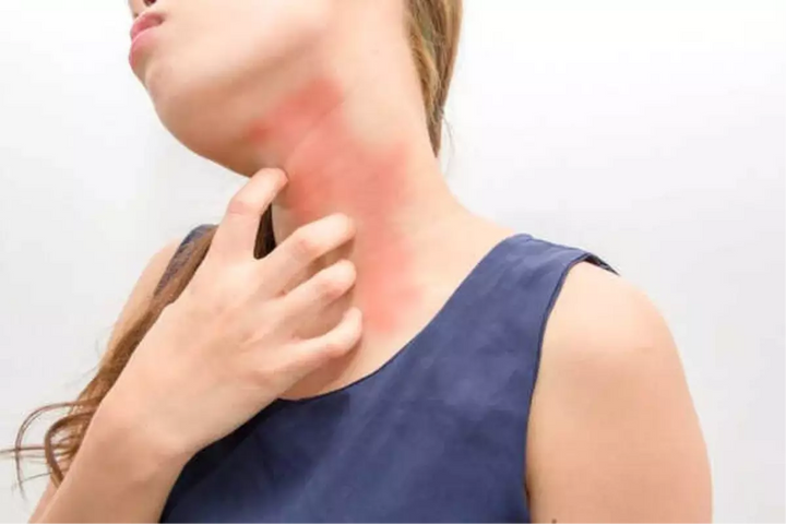 Skin, Stress, and Scabs: The NRT Troubleshooting Guide
